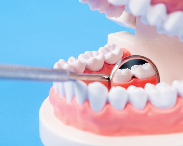 How to Remineralize Enamel Naturally for Sensitivity