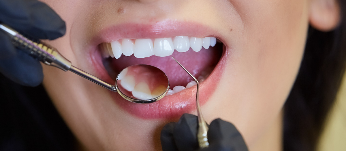Oral Microbiome Basics: Simple Habits for Better Balance