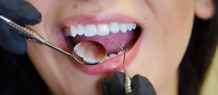 Oral Microbiome Basics: Simple Habits for Better Balance